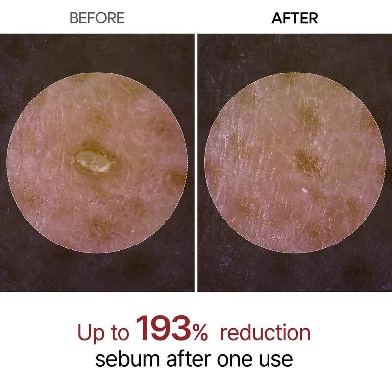 Morvyn’s Radiant Glow Rice Ampoule