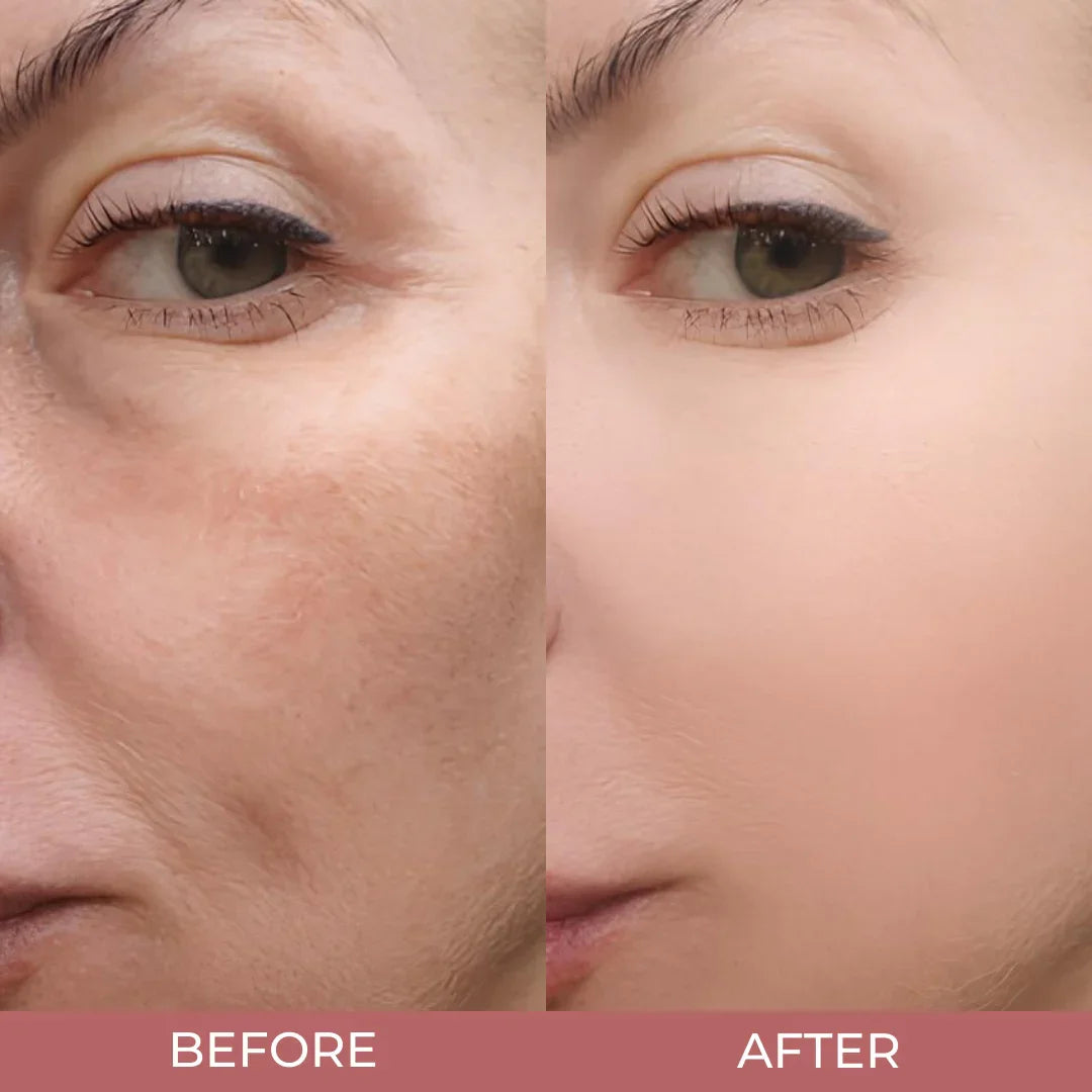 Morvyn’s Radiant Glow Rice Ampoule